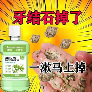 漱口水杀菌除口臭牙结石去除器牙膏溶解牙石速效神器去牙渍黄洗白