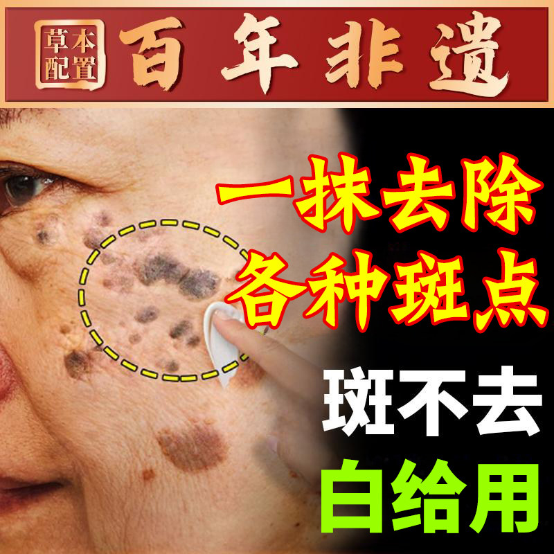 老年斑强去除力手部脸部去斑专用乳液/面霜