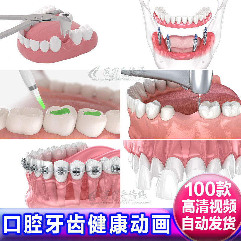 拔牙齿矫正种植假牙科蛀牙诊所医疗卫生口腔健康动画演示视频素材