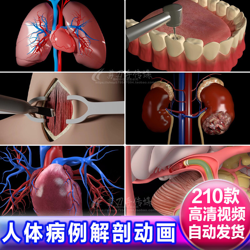 人体器官急病例心脏胰腺肠胃肝肾病变健康医疗科普动画视频素材