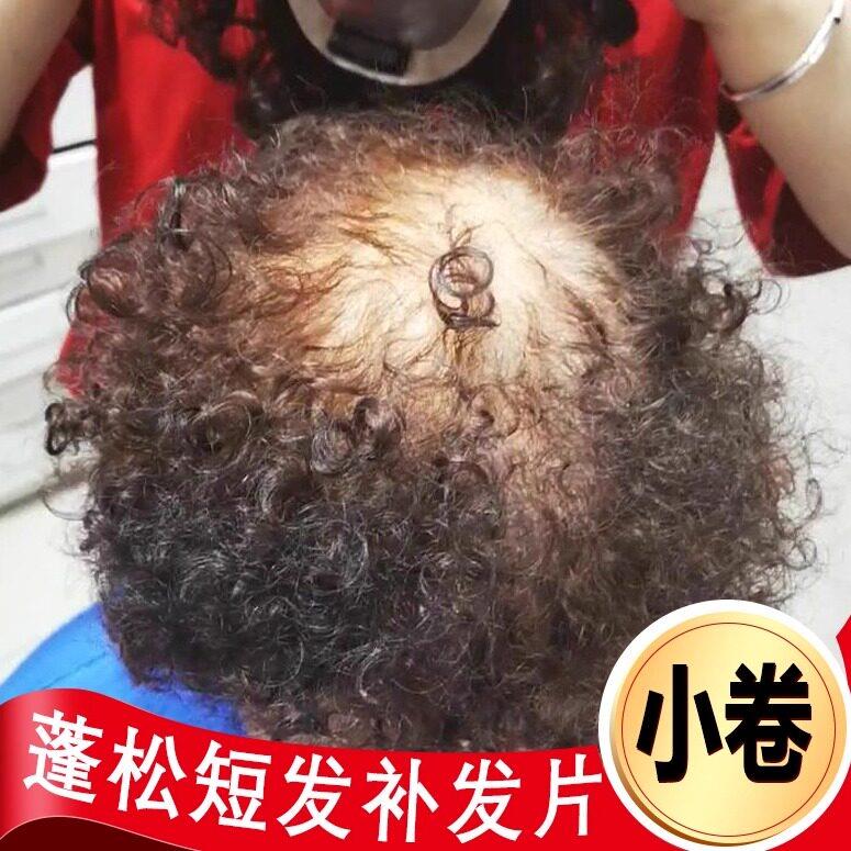 卷发假发片小卷补发块假发女短真发头顶补发片遮白发自然刘海发片