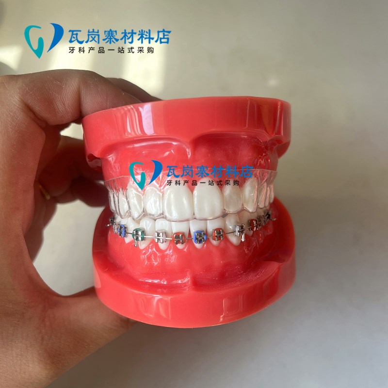 速发错颌矫正展示模型扎丝托槽正畸口腔模型透明牙齿模型牙科教学