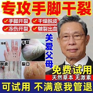 裂可宁护手霜正品治手裂的药膏防皲裂冬季防冻疮手干燥手指开裂膏
