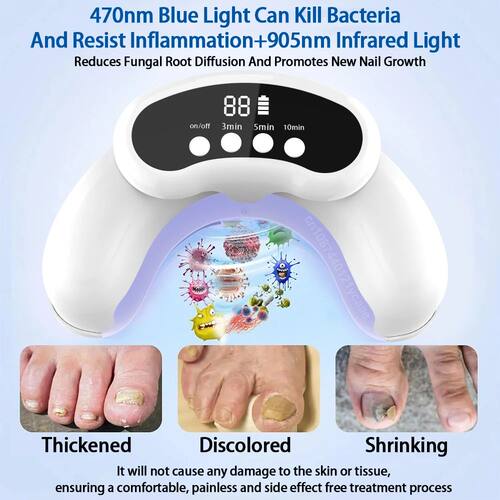 Nail Fungus Cleaning Laser Device For Multiple Toenail