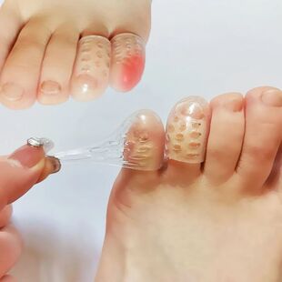 6/10pcs Toe Protector Prevents Foot Calluses Corns Blisters
