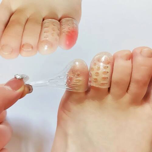 6/10pcs Toe Protector Prevents Foot Calluses Corns Blisters