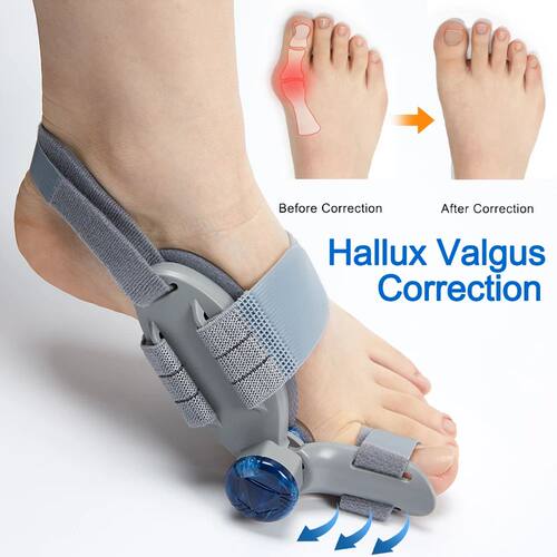 Bunion Splint Big Toe Straightener Hallux Valgus Correction
