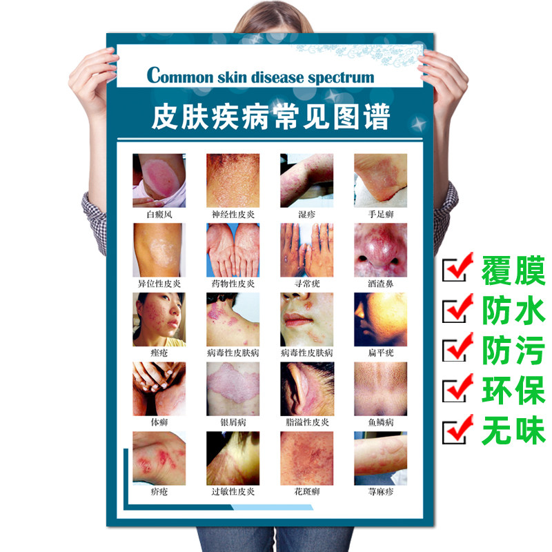 皮肤病墙贴纸皮肤疾病常见图谱医院皮肤科挂图宣传海报装饰画广告