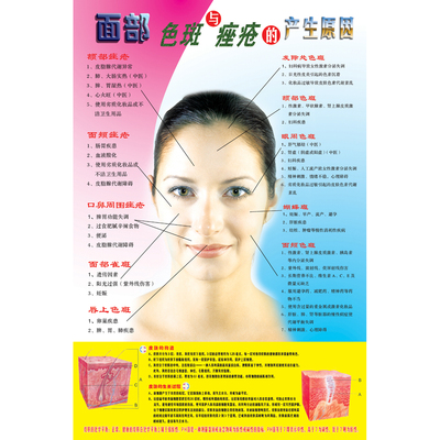 美容院装饰画 面部色斑与痤疮产生的原因图片 青春痘海报广告贴纸