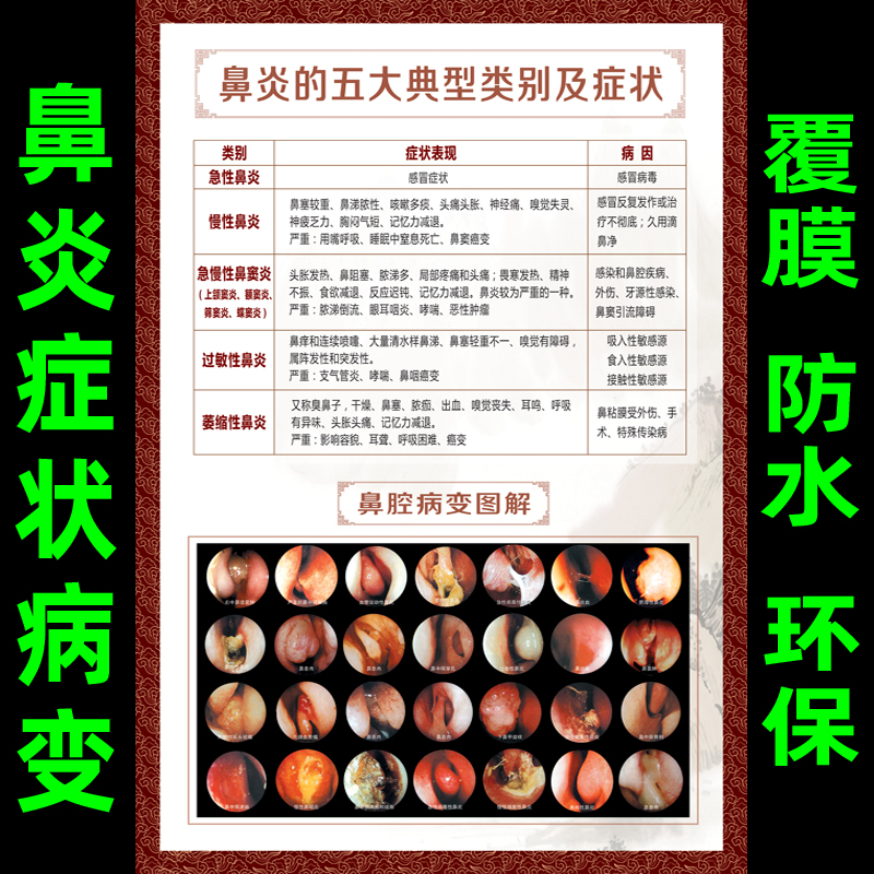 医院文化耳鼻喉鼻炎治疗症状病变挂图鼻炎的分类和自我诊断表海报