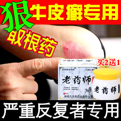 老药师抑菌乳膏水疱型脚臭手痒起水泡皮肤专治皮肤瘙痒过敏止痒药