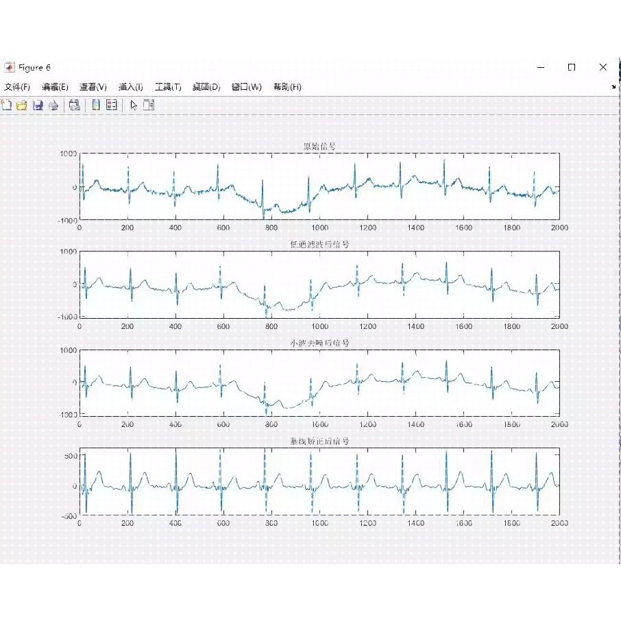 心电信号ECG去噪Matlab程序使用低通滤波和小波分解结合