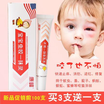 康峰宝宝虫咬一抹灵儿童成人蚊虫叮咬紫草舒缓止痒凝胶退红消包