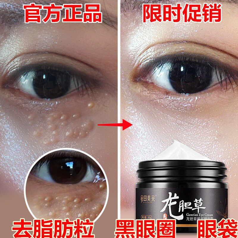 限时特惠花田美芙龙胆草眼部精华霜去脂肪粒淡化黑眼细纹眼袋眼霜