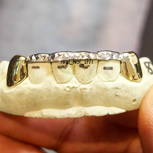 925银镀18K金牙套渔网状嘻哈大金牙说唱hiphop定制grillz6颗银饰