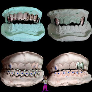 光金牙套定制K金白金Grillz Customer jewelry配饰嘻哈大金牙订做