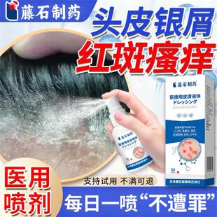 银屑病头皮屑脂溢性皮炎真菌感染头癣洗发水药监备案膏专喷雾用YJ