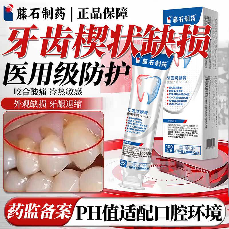 藤石制药牙齿楔状缺损搭修补膏牙龈萎缩医用敏感酸痛脱矿涂氟RD