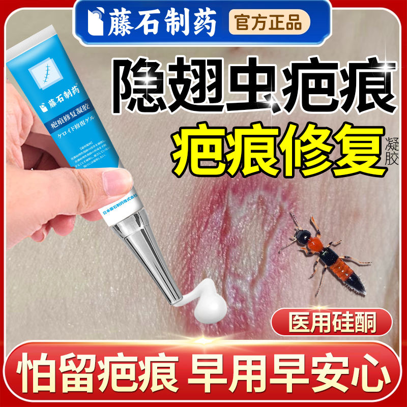 隐翅虫咬伤疤痕修复凝胶搭祛疤膏虫咬去黑红印蚊虫叮咬药监备案NP