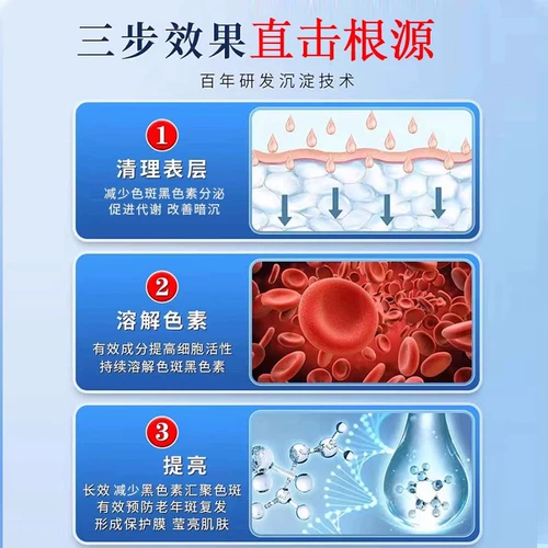 Старение пятен можно использовать для удаления задней части рук, рук, лица, рук, флагманского магазина мази,