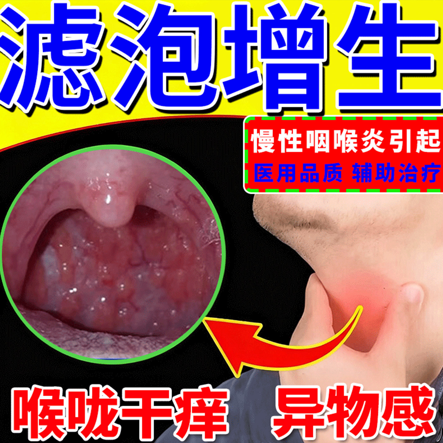 藤石制药滤泡增生慢性咽炎咽喉炎异物感磁疗喷雾剂咳嗽嗓子有痰LQ