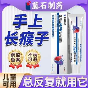 手上长瘊子手指膏疣猴子肉粒疙瘩硬肉刺寻常疣儿童药监备案去用E8