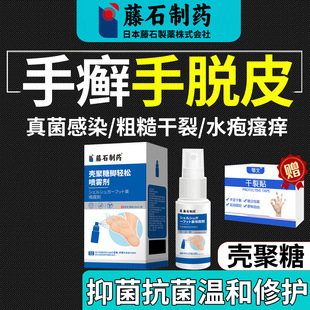 手癣膏脱皮开裂真菌感染鹅掌风角化型湿疹手脚增厚脱皮开裂喷剂SY