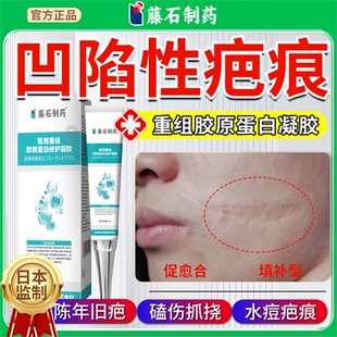 凹陷性疤痕修复去祛除疤膏再生长因子填充型重组胶原蛋白凝胶YJ