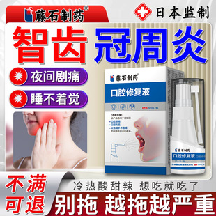 智齿牙龈肿痛消牙齿脓包牙根炎牙疼牙痛药监备案冠周炎口腔修复SY