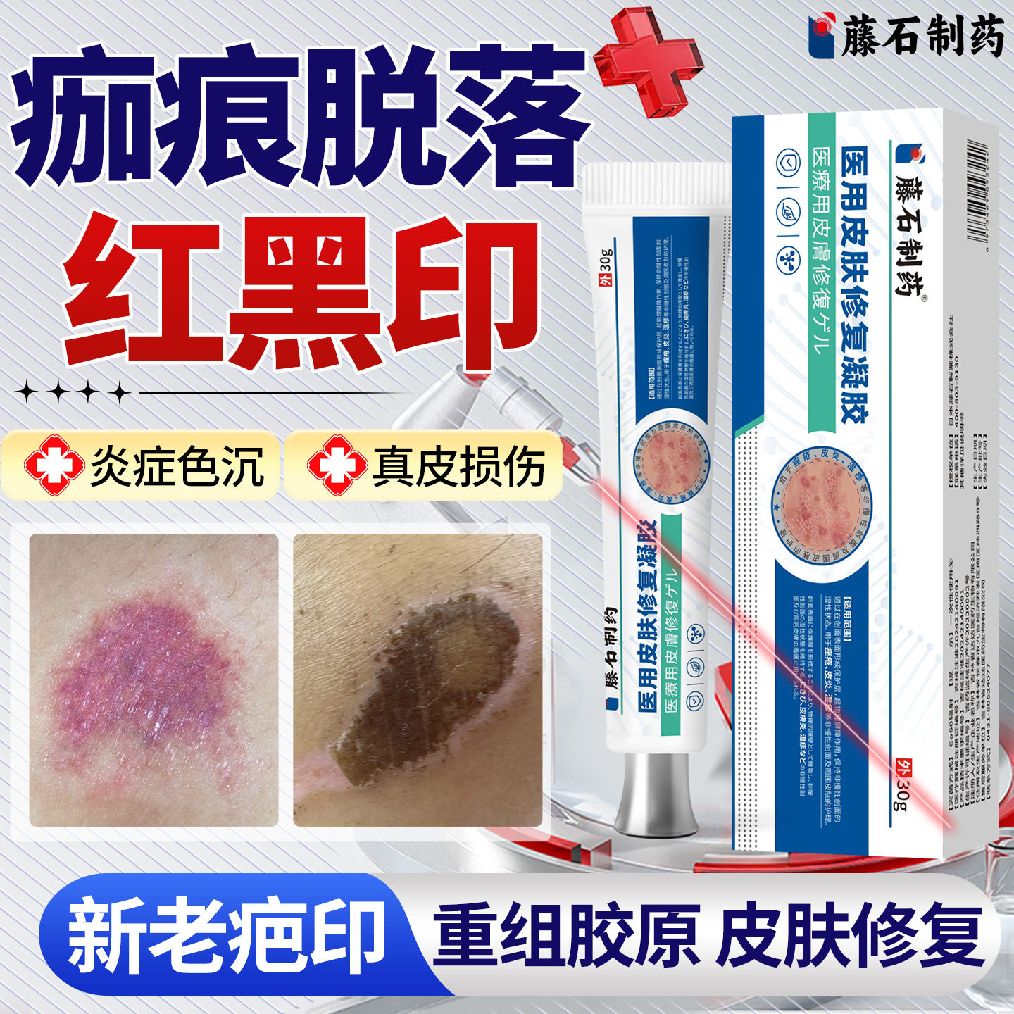 结痂掉痂后红印黑印修复图片