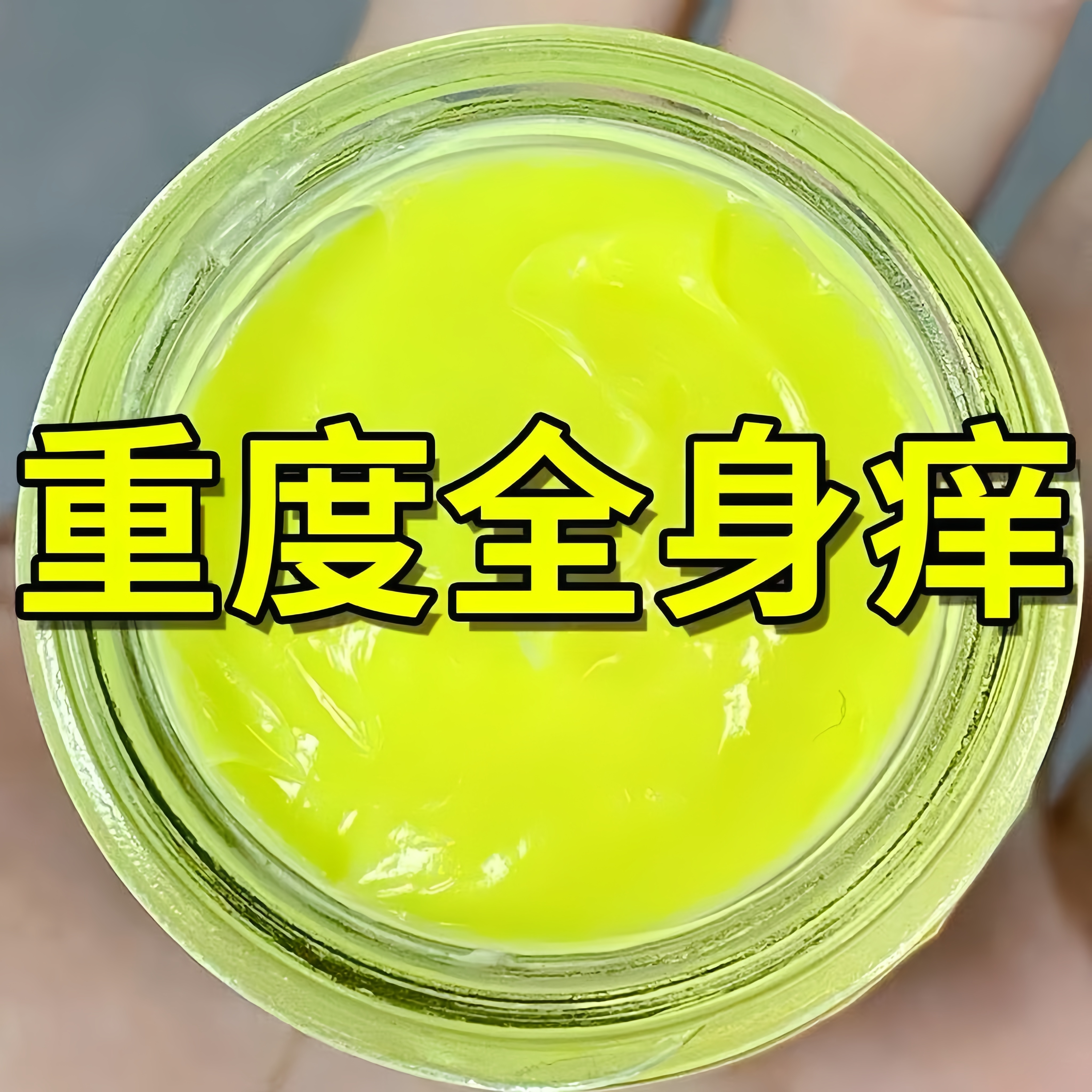 【不好可退】重度皮肤瘙痒止痒！