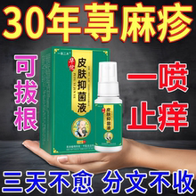 寻荨麻疹过敏止痒喷雾根断专用特效膏胆碱性急性慢性皮肤瘙痒药