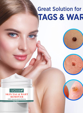 跨境 VOVA SKIN TAG & WART REMOVER CREAM  30ml 亚马逊
