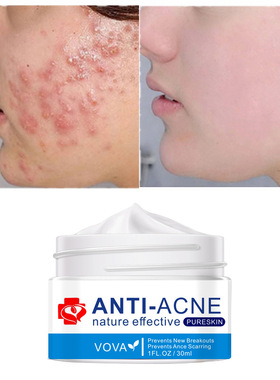 VOVA Anti-Ance Face Cream 30ml  速卖通 亚马逊 护肤品