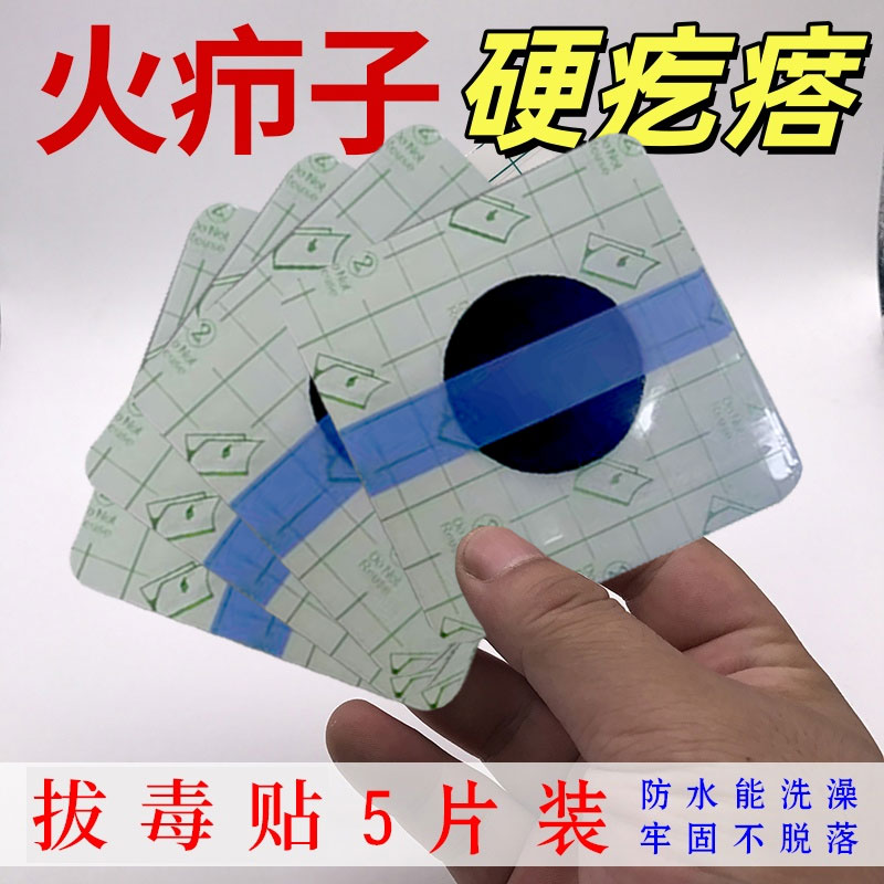 拔毒膏贴火屁股私处脓硬包块疖敷贴防水型硬红肿块痘痘子贴