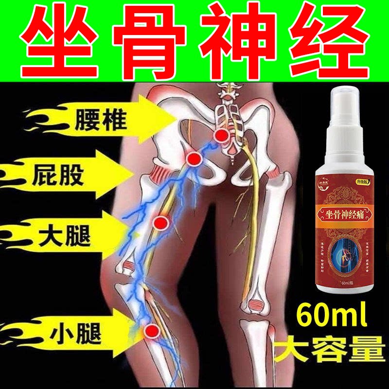 坐骨神经冷凝液60ml坐骨大腿根部腿关节专用坐骨压迫神经液疼痛麻