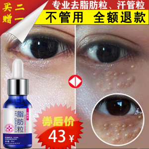 脂肪粒去除神器