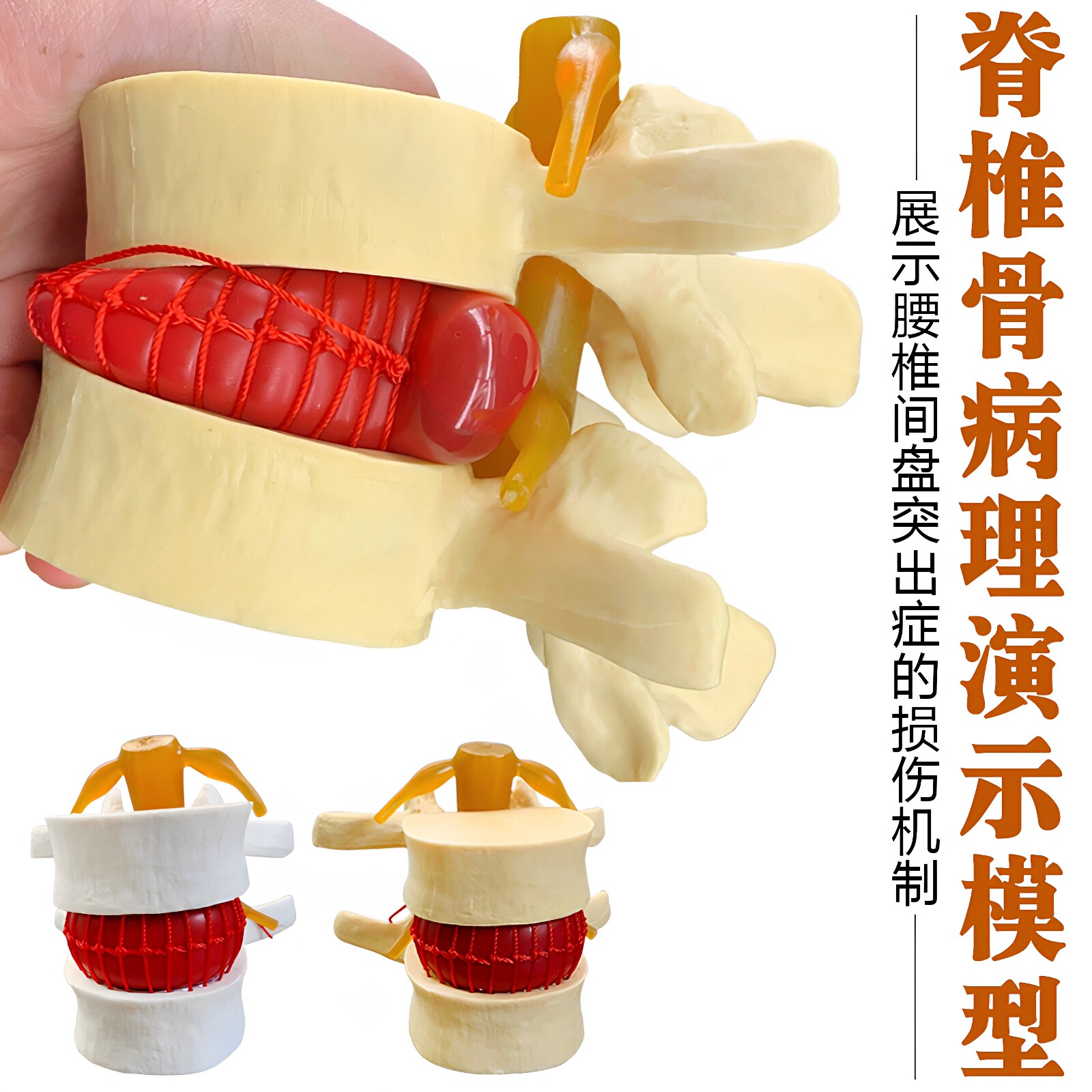 医学人体腰椎间盘受压突出演示模型脊柱脊椎关节骨骼病理侧压模型