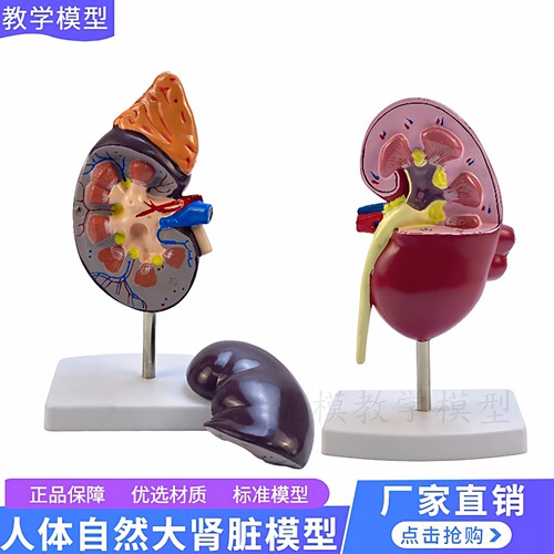 肾脏模型解剖病理肾肾部标本