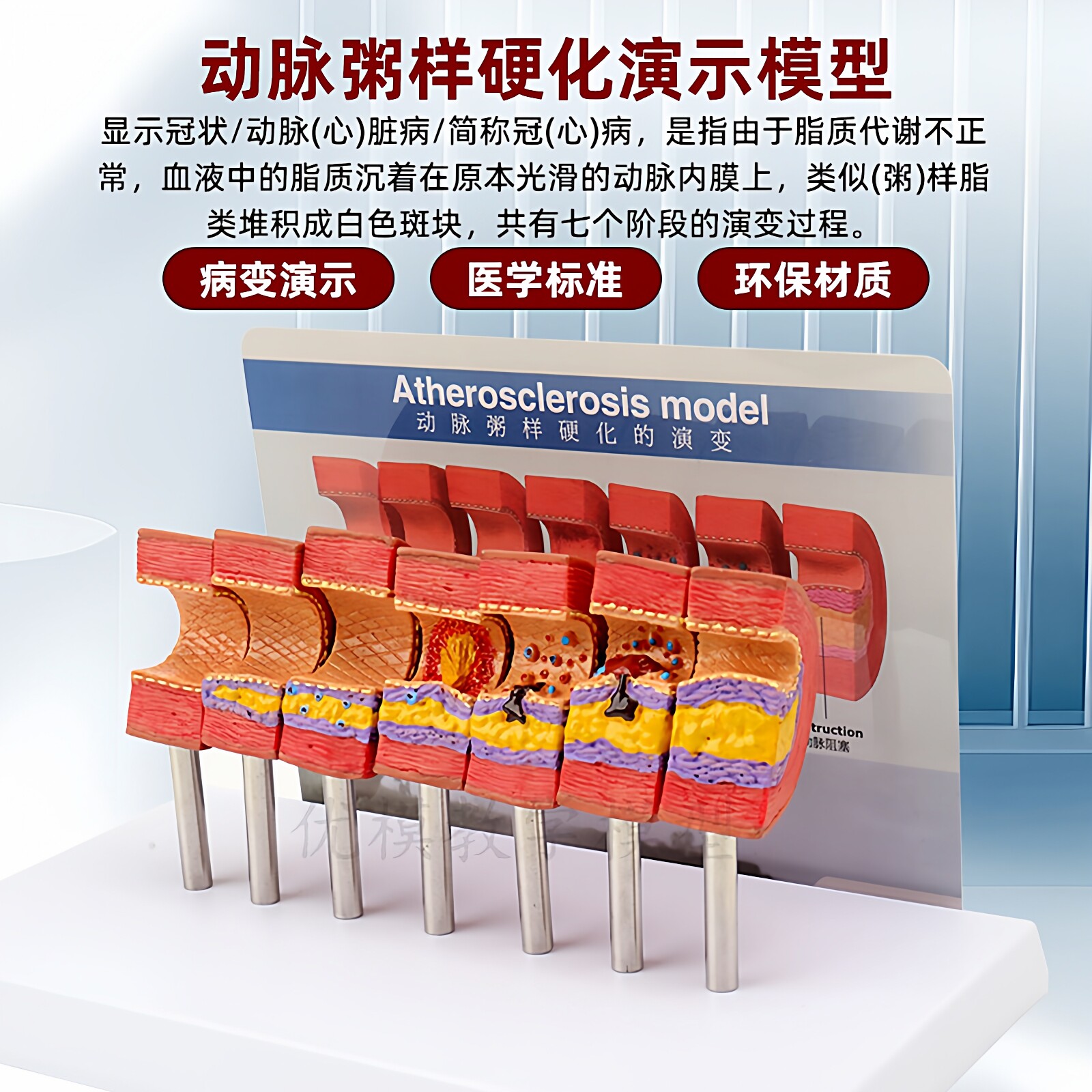 动脉粥样硬化模型血管血栓栓塞模型动脉血管人体医用医学教学模型