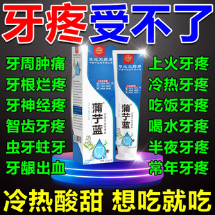 牙疼死对头】蒲丁蓝牙疼杀神经牙齿敏感药缓解肿痛蛀牙齿保健膏XX