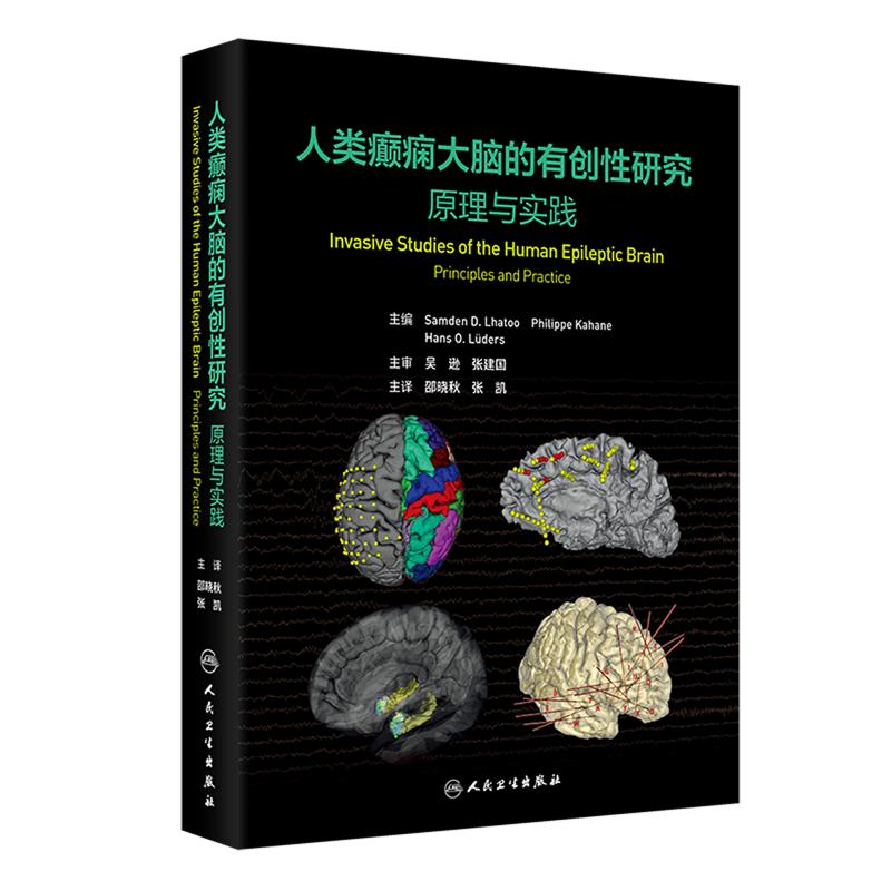 人类癫痫大脑的有创性研究:原理与实践