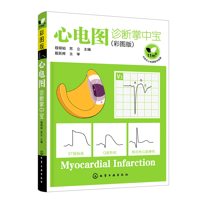 心电图诊断掌中宝:彩图版