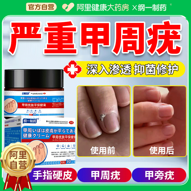 甲周疣儿童手指软化疣瘊肉粒神器去除硬皮去手指长疣儿童甲周疣