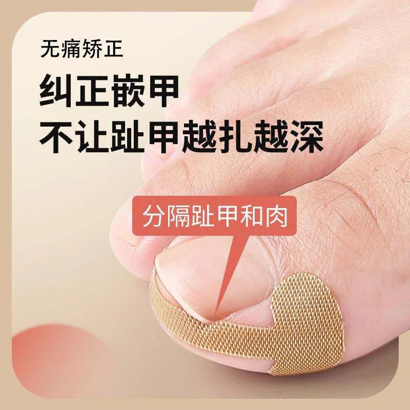 【指甲矫正贴】无痛矫正高力回弹