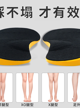 日本o型腿鞋垫儿童成人xo足外内翻内外八字脚纠正直腿