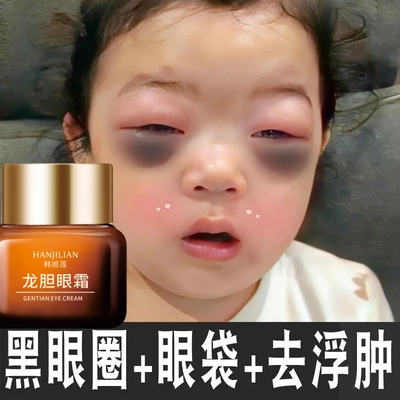 黑眼圈去除神器特别严重男