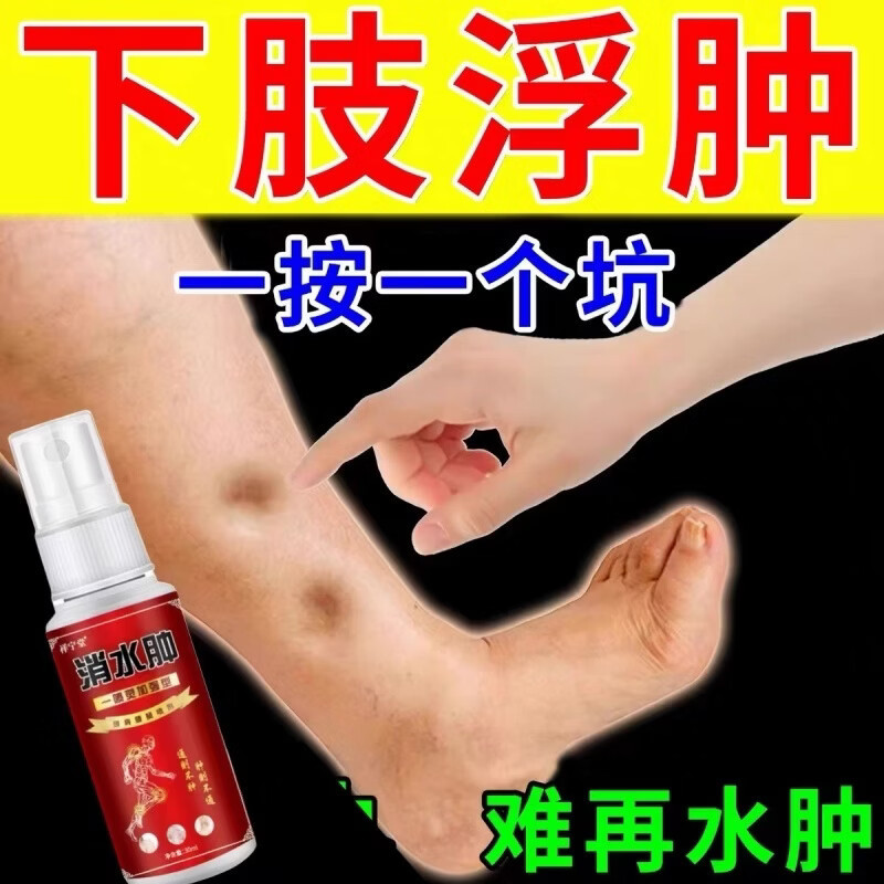 久坐久站去水肿专用中老年人脚肿利尿排小腿水肿下肢特水肿效喷剂