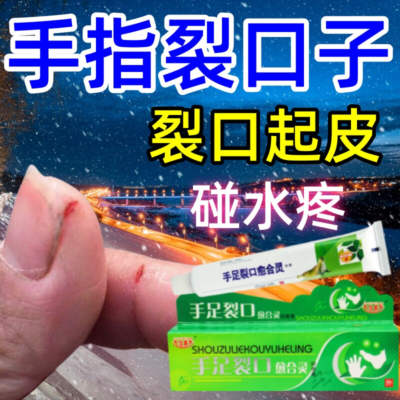 手裂口脱皮药膏手指严重裂口指甲缝裂口脚后干裂防皲裂开裂修复霜