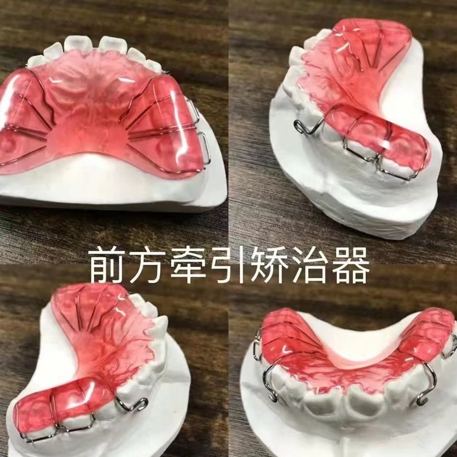 儿童定制包天矫正器反颌牙同款反颌牵引矫治器地包天前方牵引器